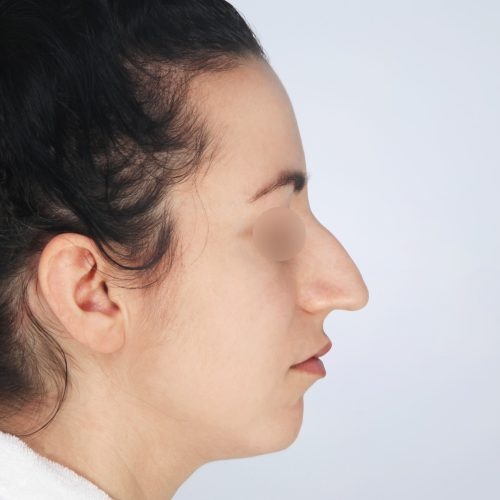 Kulicki8A-59365-aspect-ratio-500-500