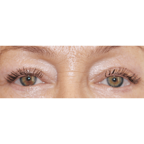 Michal1B-2-aspect-ratio-500-500