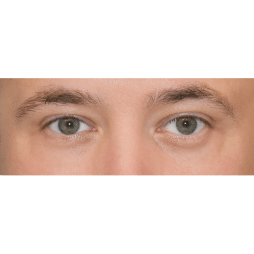 Michal2B-1-aspect-ratio-500-500