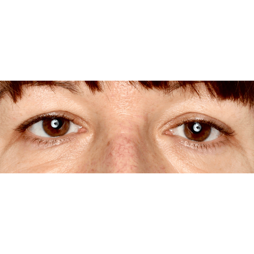 Michal5A-1-aspect-ratio-500-500