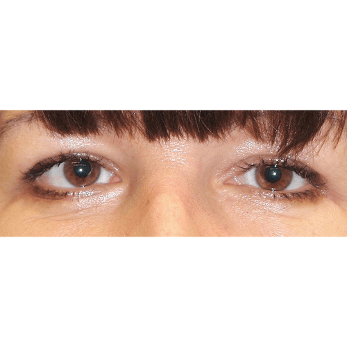 Michal5B-1-aspect-ratio-500-500