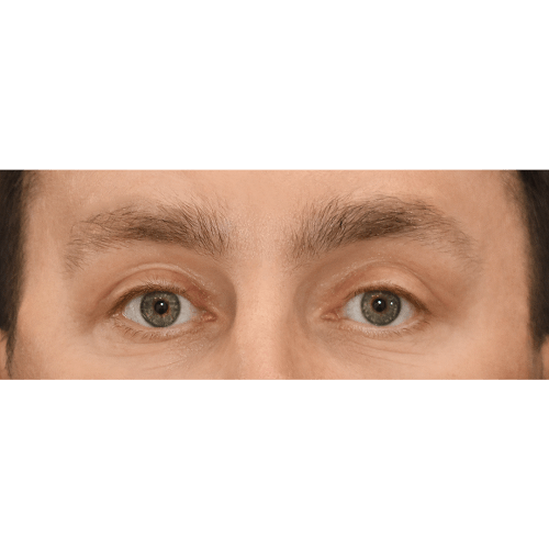 Michal8B-aspect-ratio-500-500