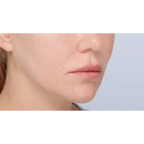 Miszczyk1A-56940-aspect-ratio-500-500