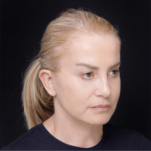 Miszczyk3B-60554-aspect-ratio-500-500