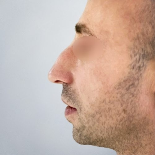 Stabryla1A-aspect-ratio-500-500