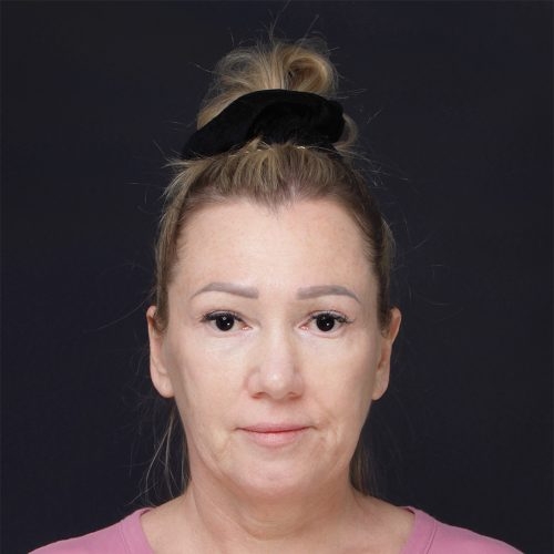 lift-Daria-62504-1A-aspect-ratio-500-500