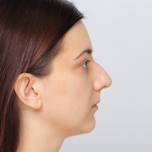 10A-Copy-aspect-ratio-500-500