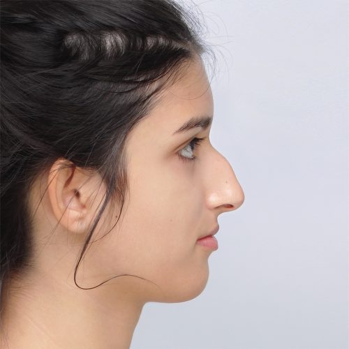 11A-Copy-aspect-ratio-500-500