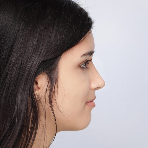 11B-Copy-aspect-ratio-500-500