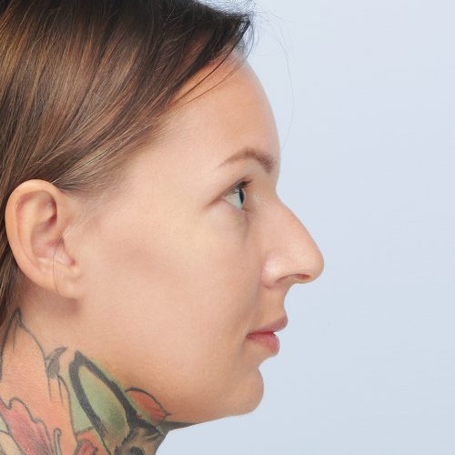 23A-mamy-zgode-1-aspect-ratio-500-500