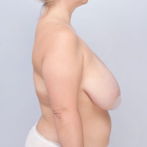 Daria20A-60248-aspect-ratio-500-500