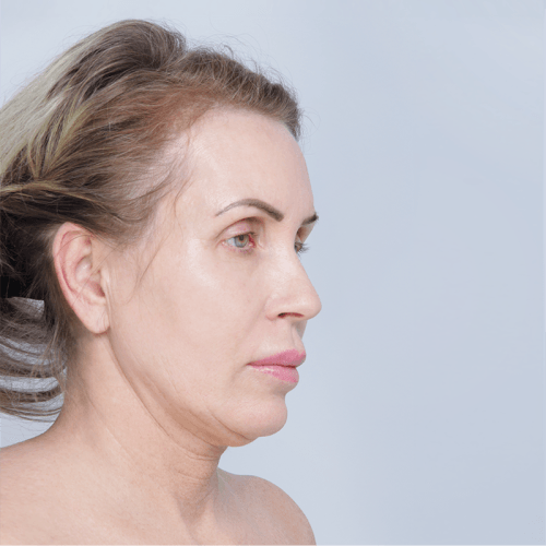 Daria2A-56620-1-aspect-ratio-500-500