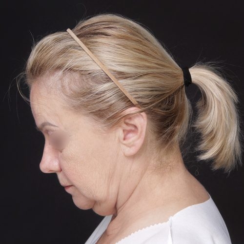 Daria5A-60319-aspect-ratio-500-500