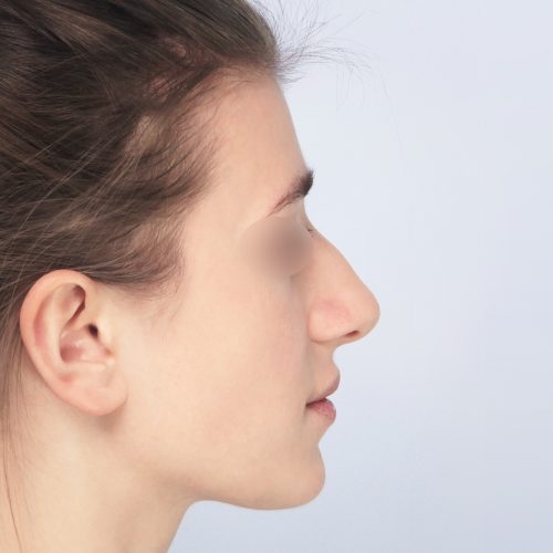 Daria9A-58664-aspect-ratio-500-500