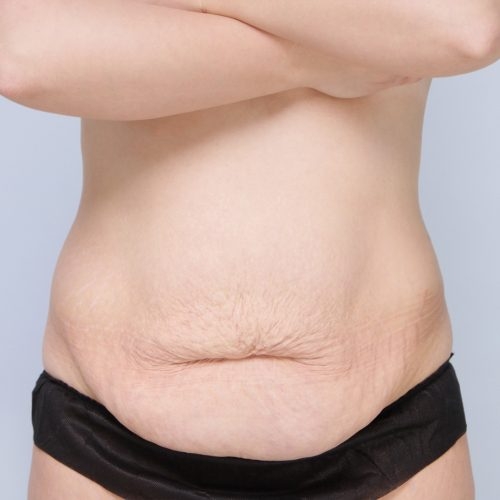 Daria9A-59126-aspect-ratio-500-500