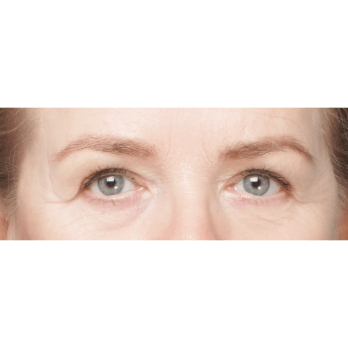 Ferenc-powieki-sameoczy-63608-3C-aspect-ratio-500-500