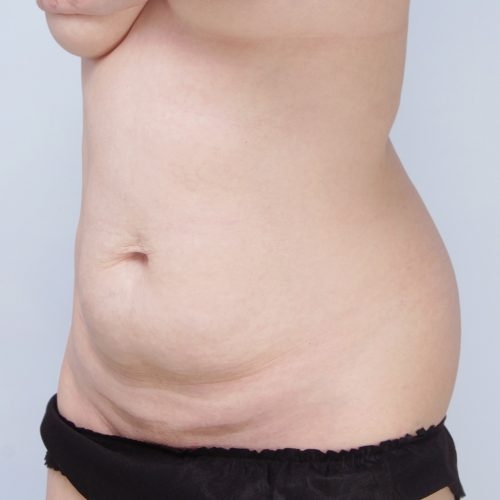 Ferenc3A-62639-aspect-ratio-500-500