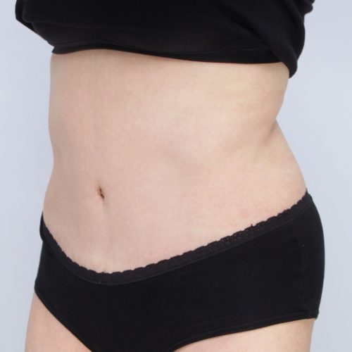 Ferenc3B-62639-aspect-ratio-500-500