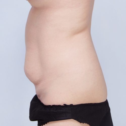 Ferenc4A-62639-1-aspect-ratio-500-500