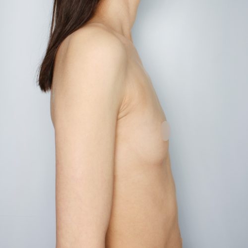 Kulicki1A-2-aspect-ratio-500-500