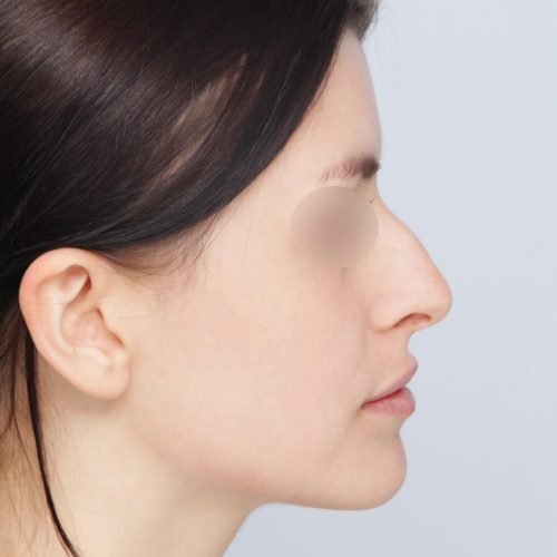 Kulicki3A-aspect-ratio-500-500