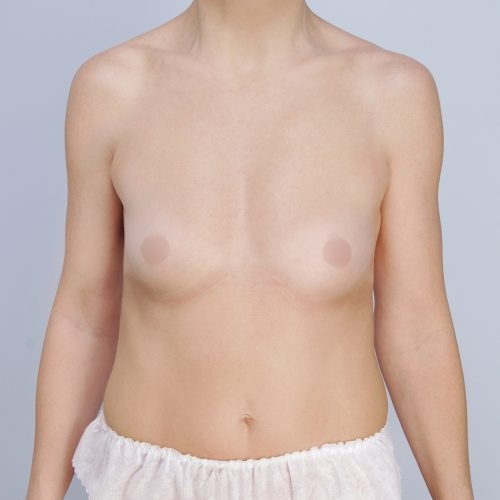 Kulicki5A-1-aspect-ratio-500-500