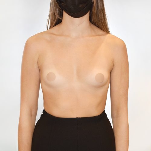 Michal1A-3-aspect-ratio-500-500