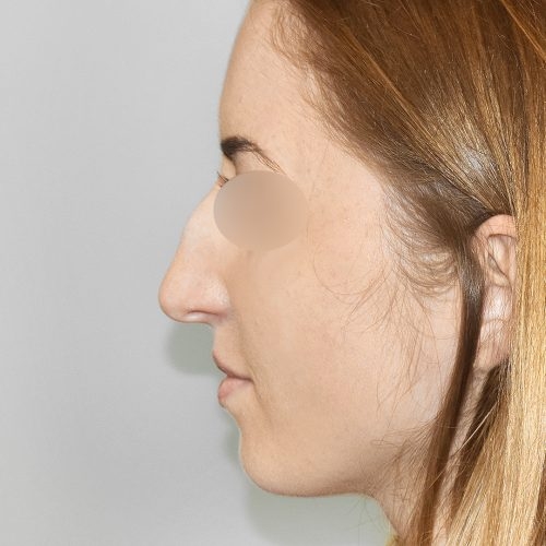 Michal1A-4-aspect-ratio-500-500