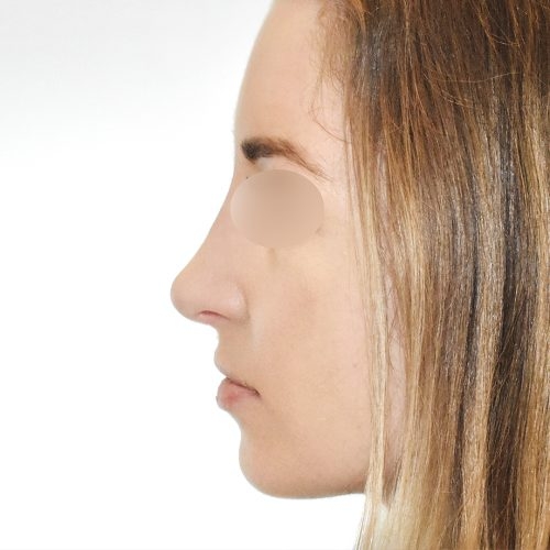 Michal1B-4-aspect-ratio-500-500