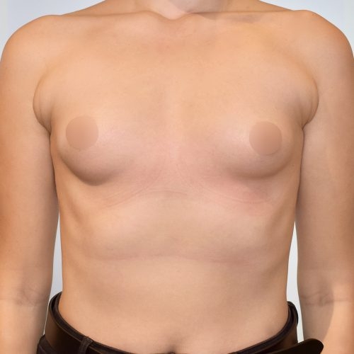 Michal2A-3-aspect-ratio-500-500