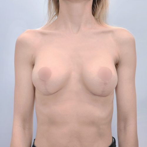 Michal2B-2-aspect-ratio-500-500