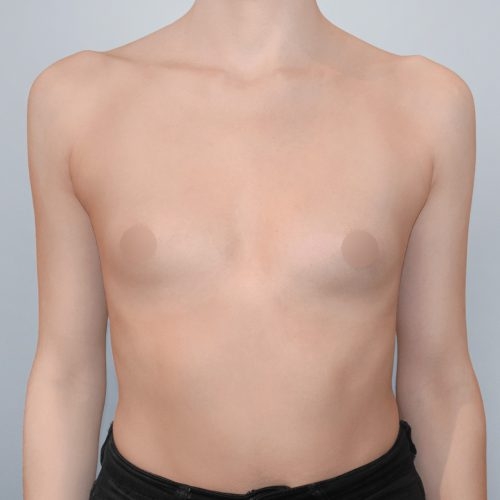 Michal4A-2-aspect-ratio-500-500