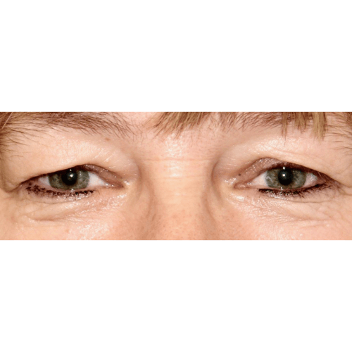 Michal4A-aspect-ratio-500-500