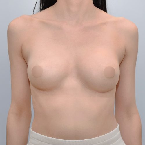 Michal4B-2-aspect-ratio-500-500