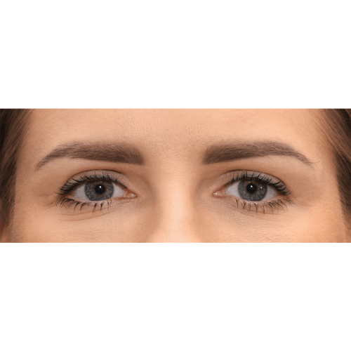 Michal5A-Copy-aspect-ratio-500-500