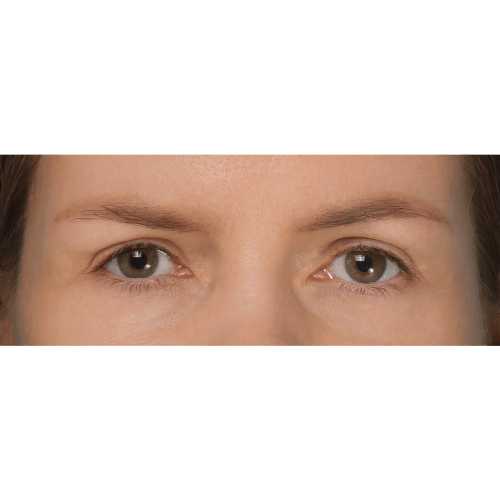 Michal6A-Copy-aspect-ratio-500-500