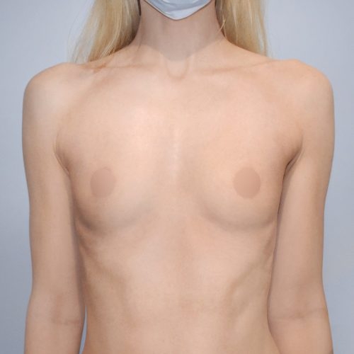 Michal6A-aspect-ratio-500-500