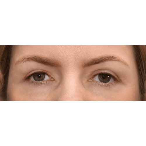 Michal6B-Copy-aspect-ratio-500-500