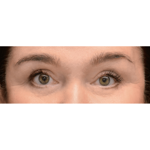 Michal8B-aspect-ratio-500-500