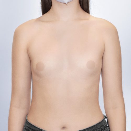 Michal9A-aspect-ratio-500-500