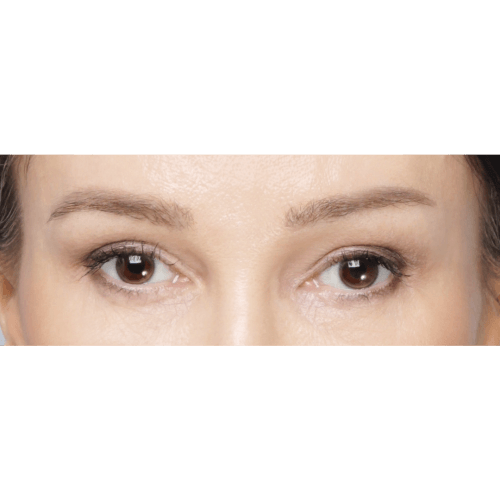 Miszczyk-brwi-5B-IMG-5676-aspect-ratio-500-500