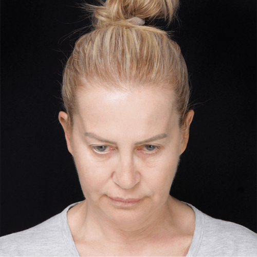 Miszczyk1A-60554-mamy-zgode-aspect-ratio-500-500