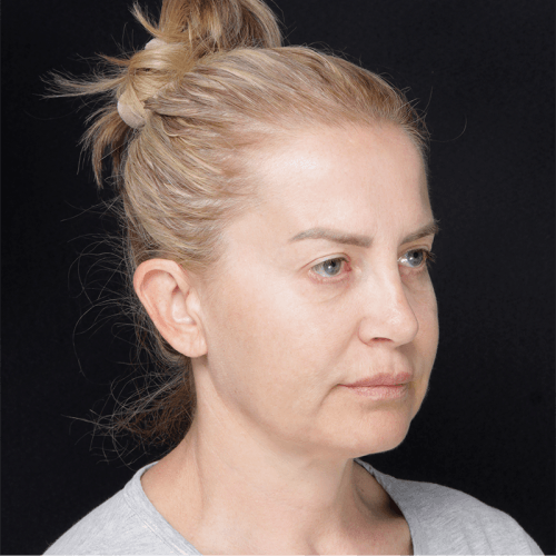 Miszczyk3A-60554-mamy-zgode-1-aspect-ratio-500-500