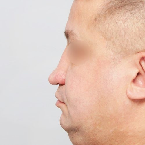 Stabryla3A-Copy-aspect-ratio-500-500