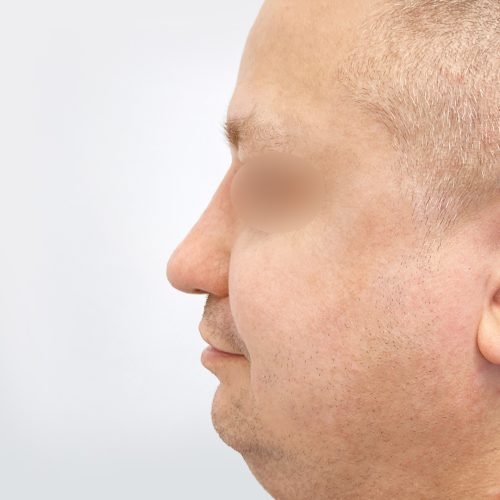 Stabryla3B-Copy-aspect-ratio-500-500