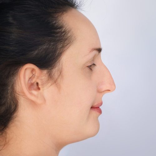 Stabryla4A-Copy-aspect-ratio-500-500