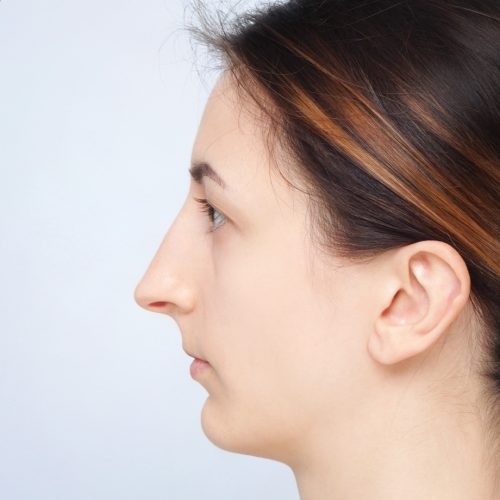 Stabryla5A-58446-mamy-zgode-Copy-aspect-ratio-500-500