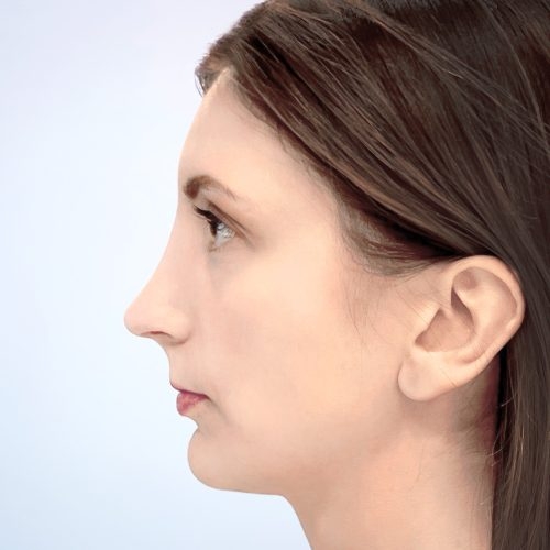 Stabryla5B-58446-Copy-aspect-ratio-500-500