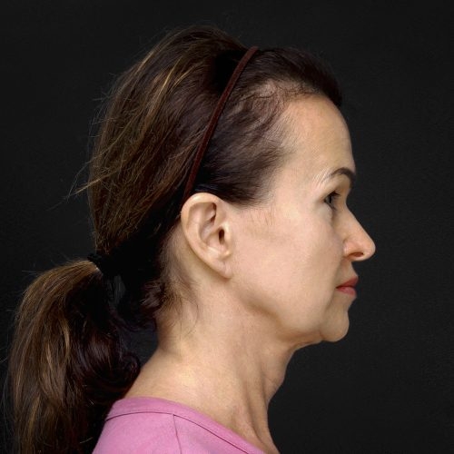 lift-Michal-12A-aspect-ratio-500-500