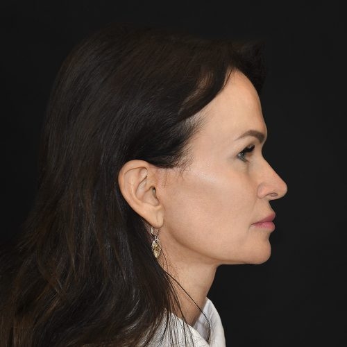 lift-Michal-12B-aspect-ratio-500-500